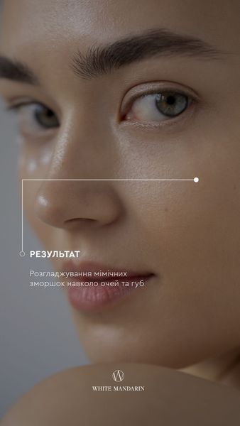 Гель для контуру очей та губ "Мікс водоростей" ACTIVE LIFTING, 30 ml 121213131414 фото